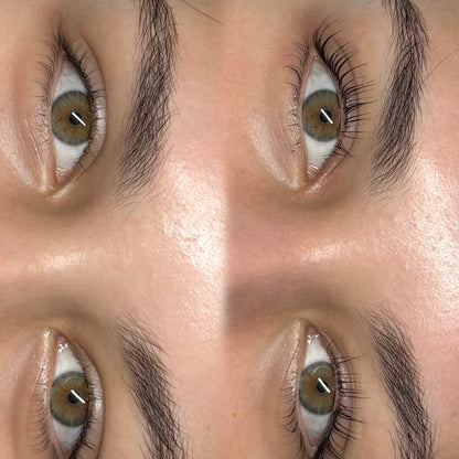 STEP 1 – HCL Lifting Lotion